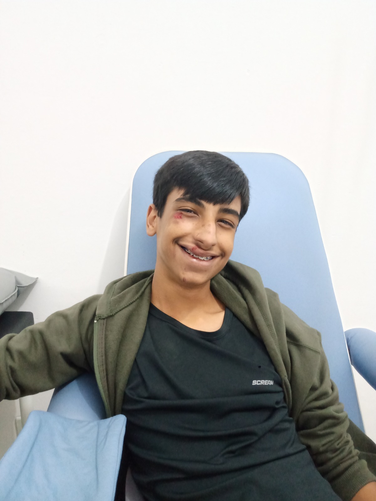 Imagem 1 de pedrox quebra o braco