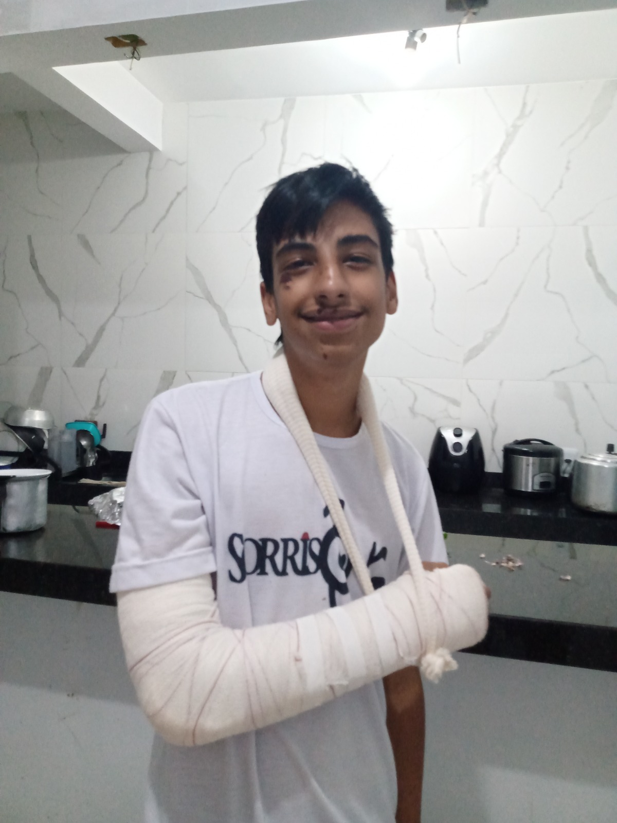 Imagem 2 de pedrox quebra o braco